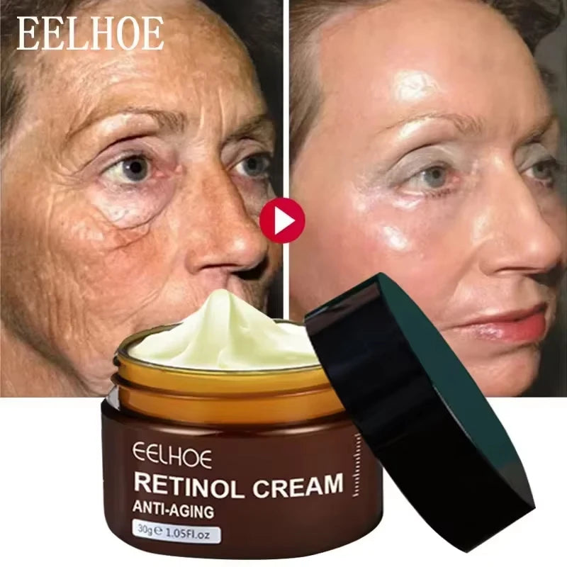 Sheromom's Retinol Wrinkle Remover Face Cream Firming Lifting Anti-Aging Fade Fine Lines Moisturizing Whitening Skin Care Korean Cosmetics