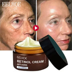 Sheromom's Retinol Wrinkle Remover Face Cream Firming Lifting Anti-Aging Fade Fine Lines Moisturizing Whitening Skin Care Korean Cosmetics