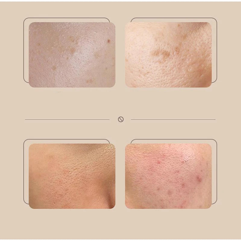 Sheromom's Korean Rice Extract Cream Spf50+ Hydrate Moisturizing Improve Dullness Even Out Brighten Skin Tone Last Light-feeling Concealer