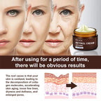 Sheromom's Retinol Wrinkle Remover Face Cream Firming Lifting Anti-Aging Fade Fine Lines Moisturizing Whitening Skin Care Korean Cosmetics