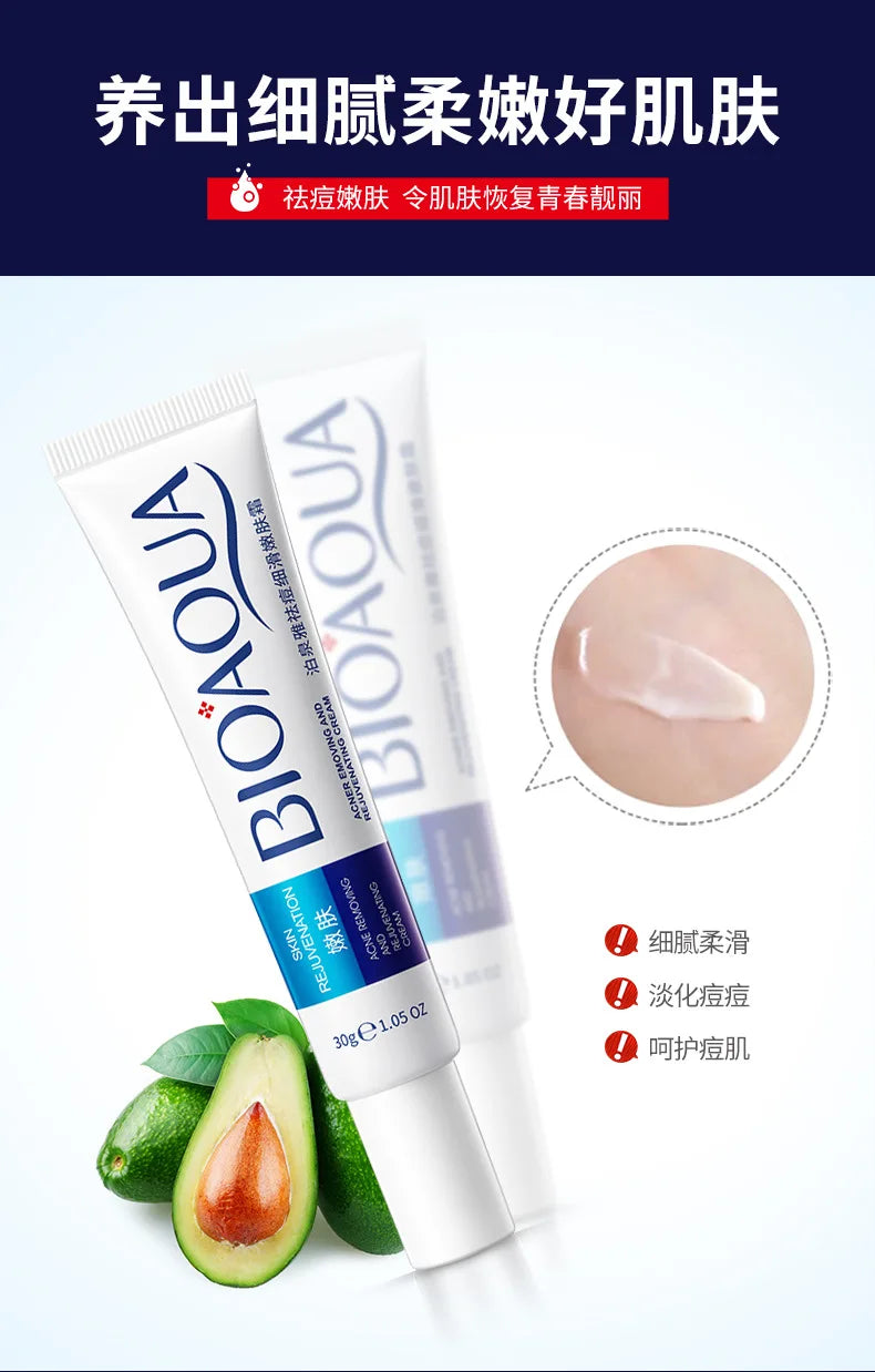 Sheromom's Treatment Cream Face Acne Remover Repair Gel Oil Control Serum Shrink Pores Whitening Facial mask Skin Care Korean Cosmetic