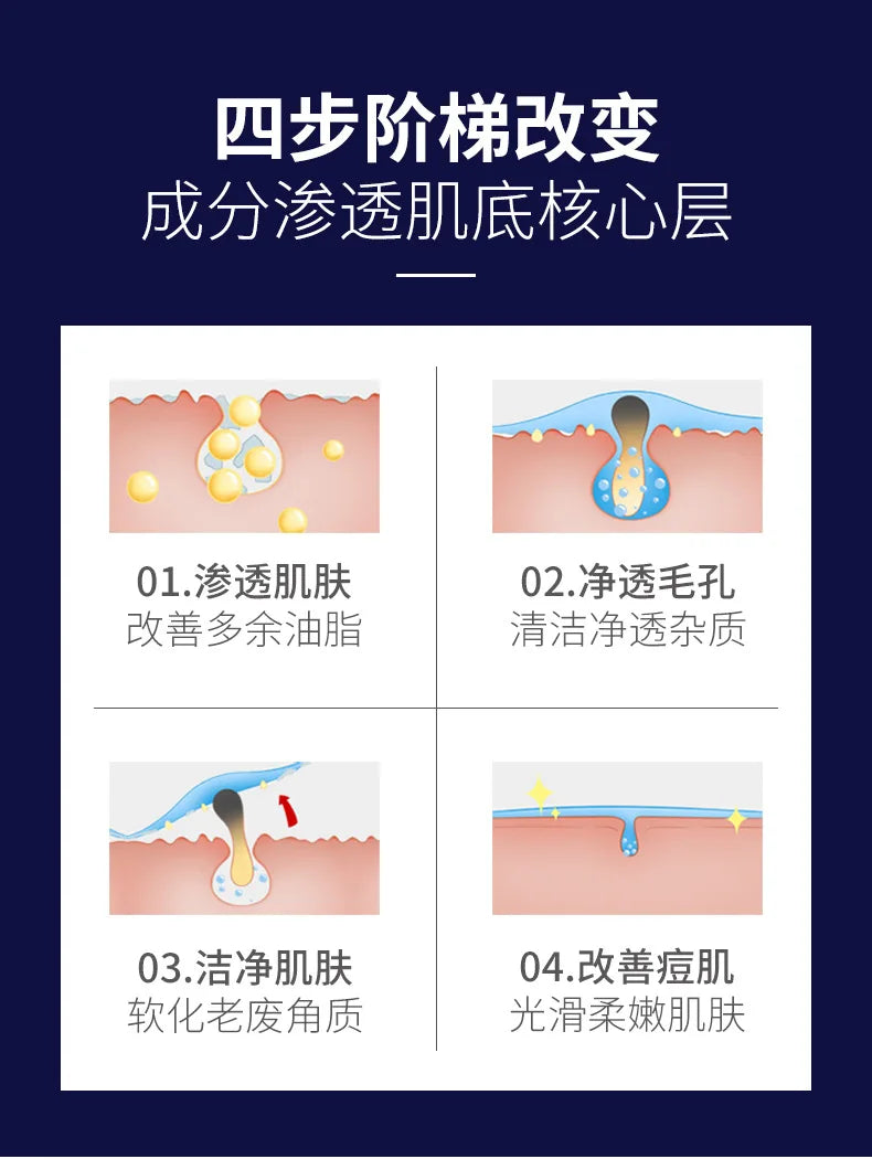 Sheromom's Treatment Cream Face Acne Remover Repair Gel Oil Control Serum Shrink Pores Whitening Facial mask Skin Care Korean Cosmetic
