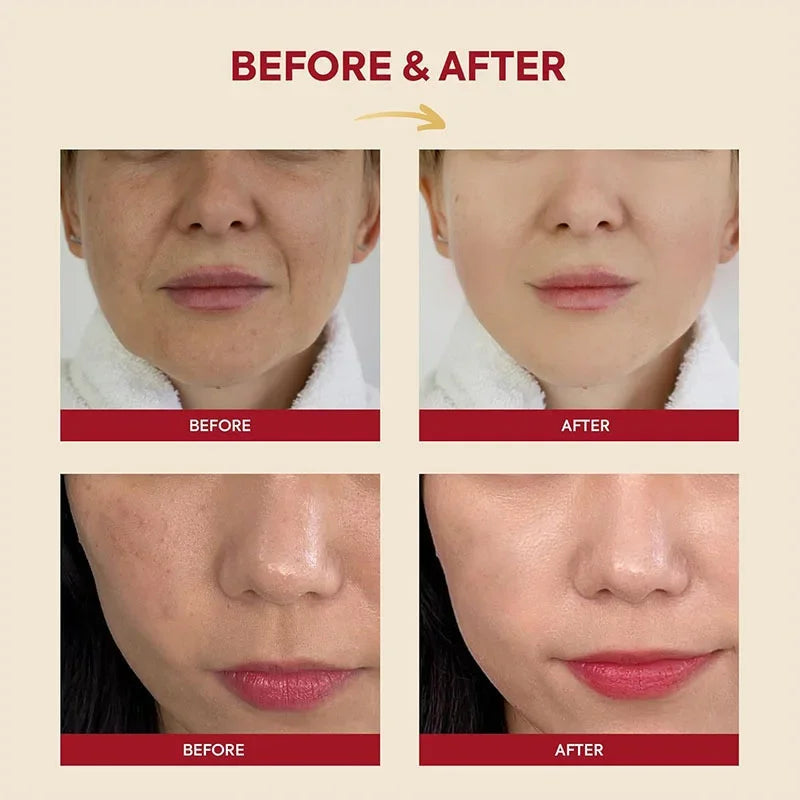 Sheromom's Korean Brand Skin Care Set Seoul 1988 Anti-aging Brightening Eye Cream Sunscreen Anti-wrinkle Essence Rice Cream Essence Water