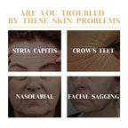 Sheromom's 10PCS Collagen Anti-Wrinkle Facial Mask Anti-Aging Fade Fine Lines Firm Skin Moisturizing Brightening Skincare Korean Cosmetics