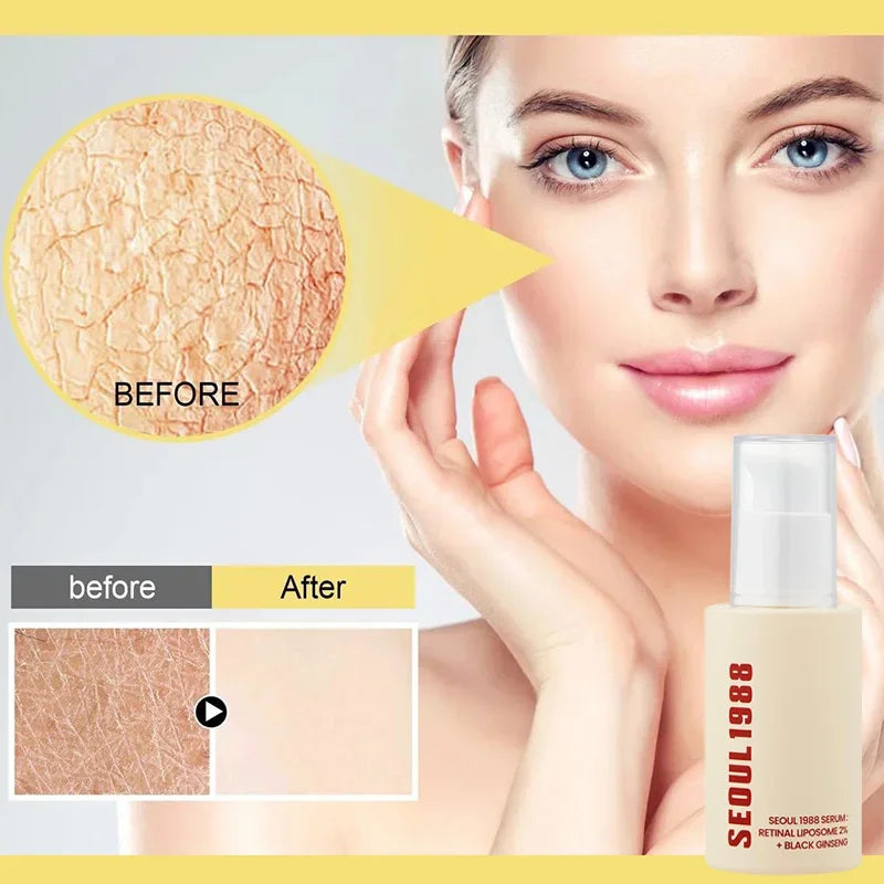 Sheromom's Korean Brand Skin Care Set Seoul 1988 Anti-aging Brightening Eye Cream Sunscreen Anti-wrinkle Essence Rice Cream Essence Water
