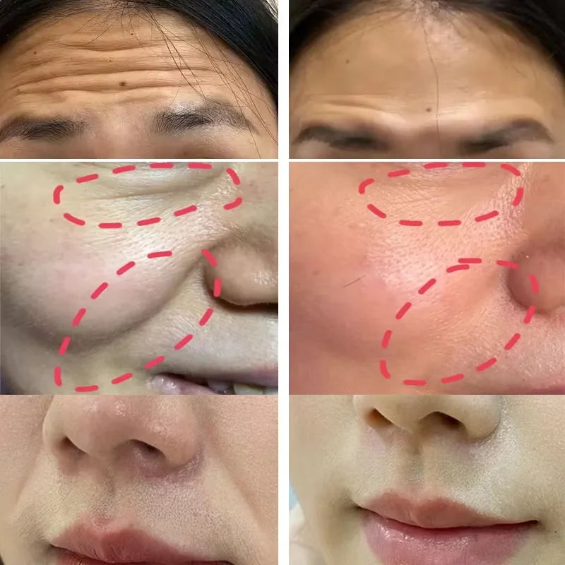 Sheromom's Collagen Wrinkle Removal Multi Bounce Balm Stick Instant Anti-Aging Firming Lift Brighten Facial Dull Skin Moisturizer Cosmetics