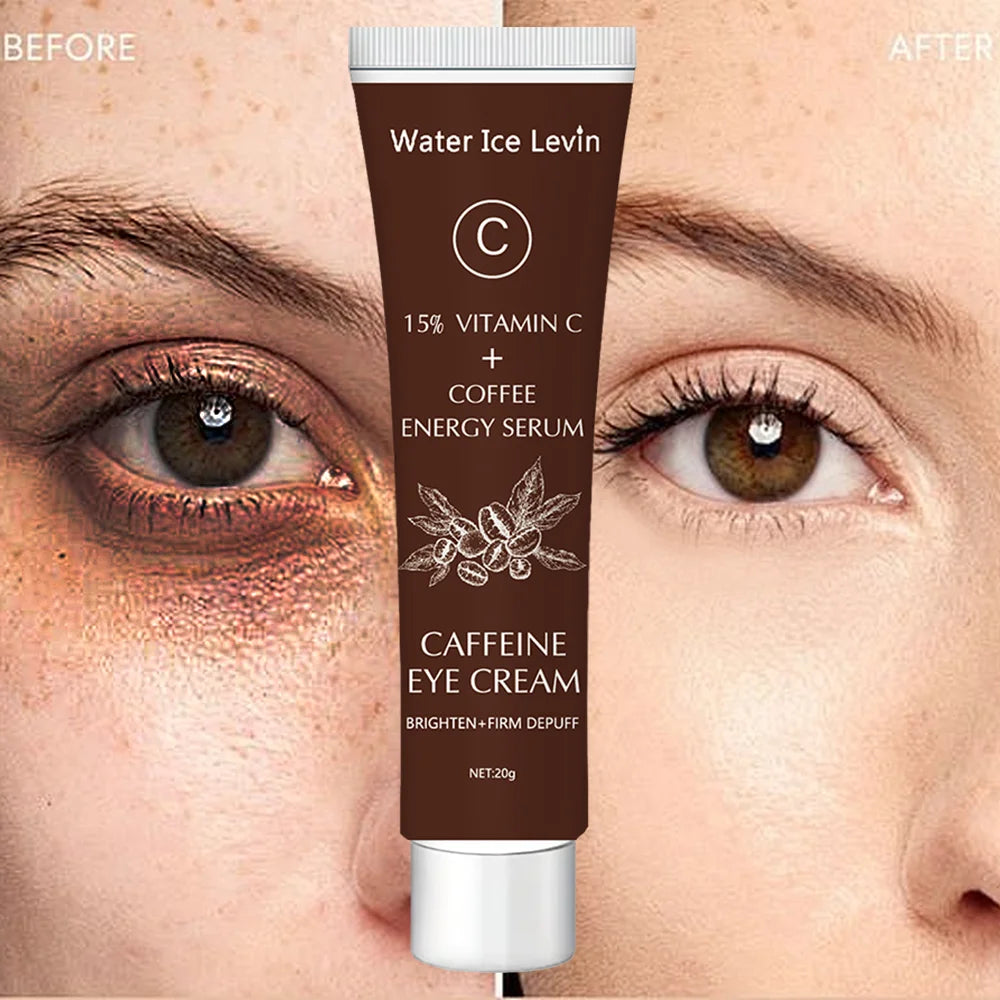 Sheromom's Caffeine Recovery eye Cream with 15% Vitamin C to Lighten dark circles and Tighten Skin Instant Eye Repair Essence Women's Eye Care