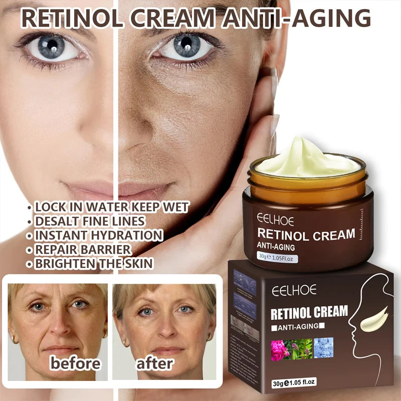 Sheromom's Retinol Wrinkle Remover Face Cream Firming Lifting Anti-Aging Fade Fine Lines Moisturizing Whitening Skin Care Korean Cosmetics