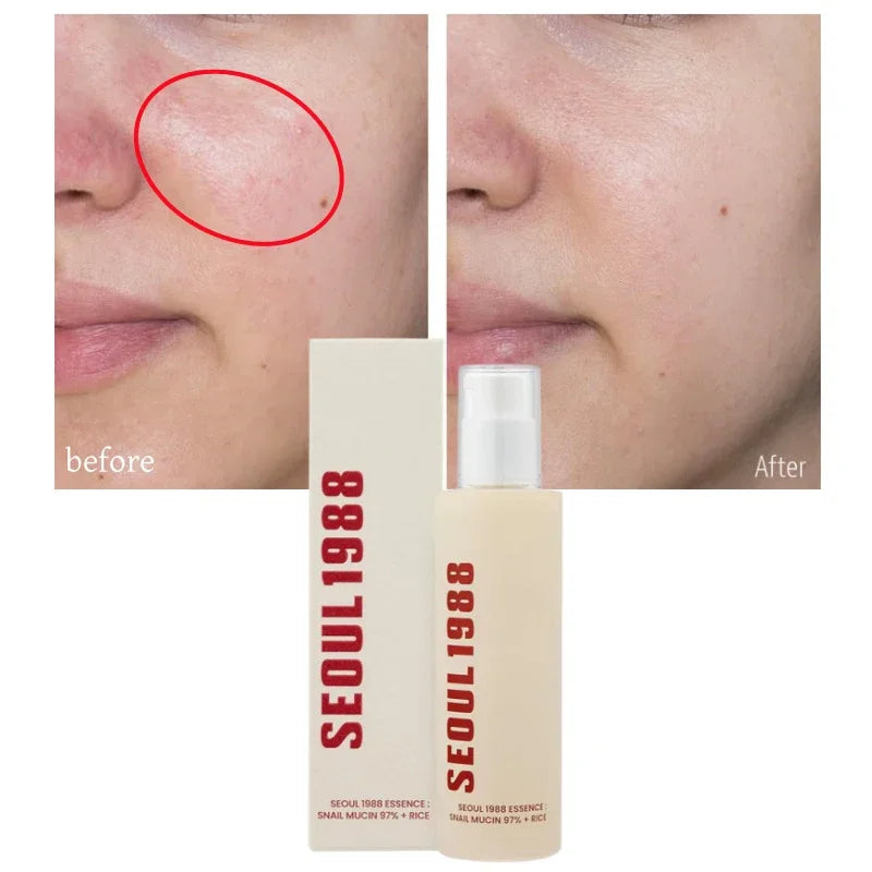 Sheromom's Korean Brand Skin Care Set Seoul 1988 Anti-aging Brightening Eye Cream Sunscreen Anti-wrinkle Essence Rice Cream Essence Water
