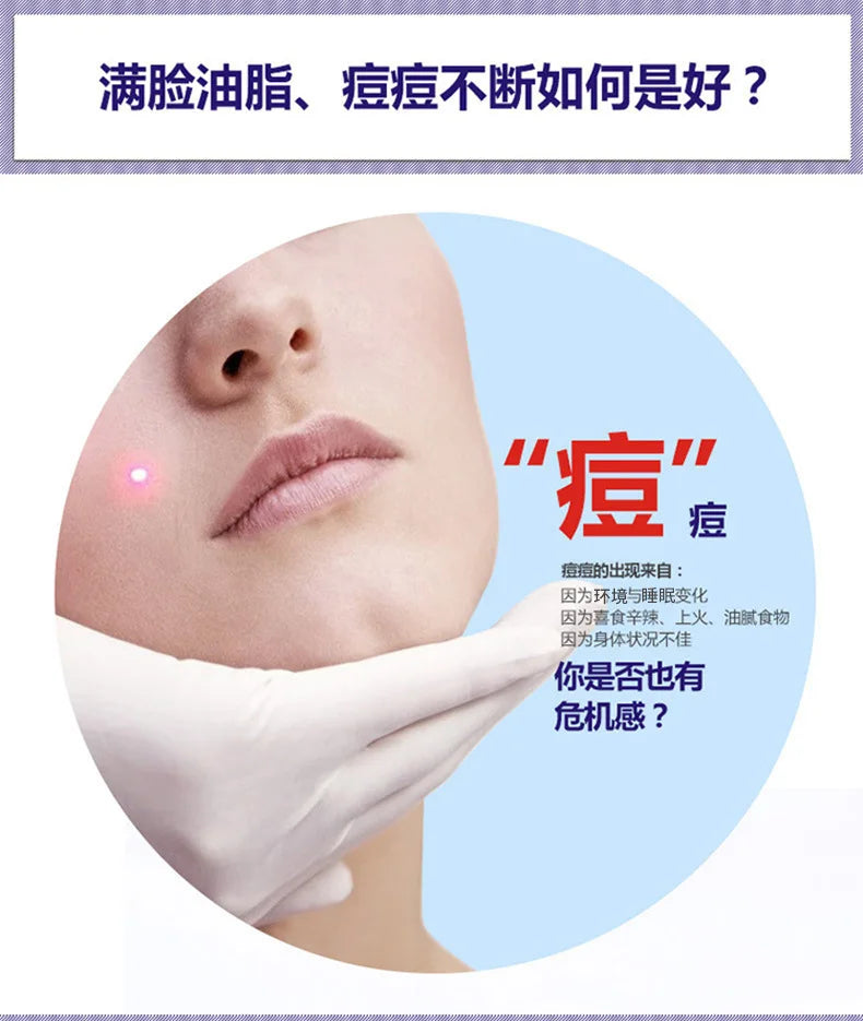 Sheromom's Treatment Cream Face Acne Remover Repair Gel Oil Control Serum Shrink Pores Whitening Facial mask Skin Care Korean Cosmetic