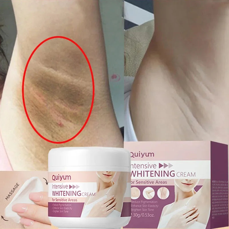Sheromom's Whitening Cream for Dark Skin Underarm Bleaching Armpit Lightening and Intimate Area Woman Moisturizer Korean Skin Care Products