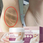 Sheromom's Whitening Cream for Dark Skin Underarm Bleaching Armpit Lightening and Intimate Area Woman Moisturizer Korean Skin Care Products