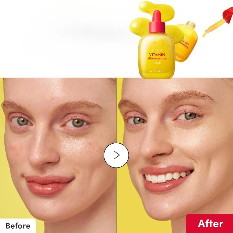 Sheromom's Korean Skin Care Vitamin Illuminating & Bakuchiol Face Serum Vitamin C Niacinamide Anti-Aging Serum Brightening Firm Skin 30ml