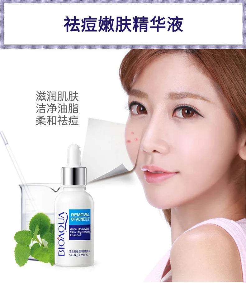 Sheromom's Treatment Cream Face Acne Remover Repair Gel Oil Control Serum Shrink Pores Whitening Facial mask Skin Care Korean Cosmetic