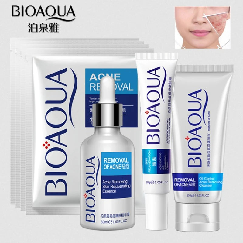 Sheromom's Treatment Cream Face Acne Remover Repair Gel Oil Control Serum Shrink Pores Whitening Facial mask Skin Care Korean Cosmetic