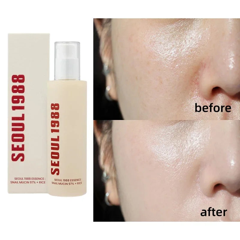Sheromom's Korean Brand Skin Care Set Seoul 1988 Anti-aging Brightening Eye Cream Sunscreen Anti-wrinkle Essence Rice Cream Essence Water