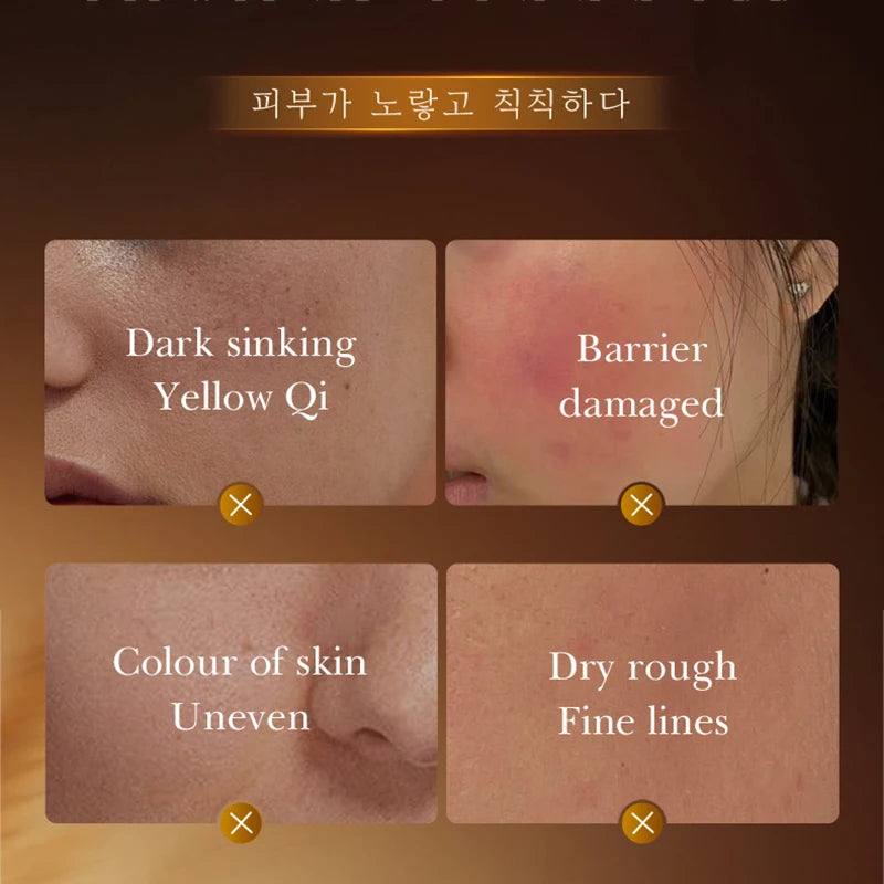 Sheromom's SADOER Rice Essence Serum Face Whitening Cream Moisturizing Hydrating Anti-aging Facial Essence Korean Skin Care Cosmetics