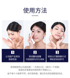Sheromom's Treatment Cream Face Acne Remover Repair Gel Oil Control Serum Shrink Pores Whitening Facial mask Skin Care Korean Cosmetic