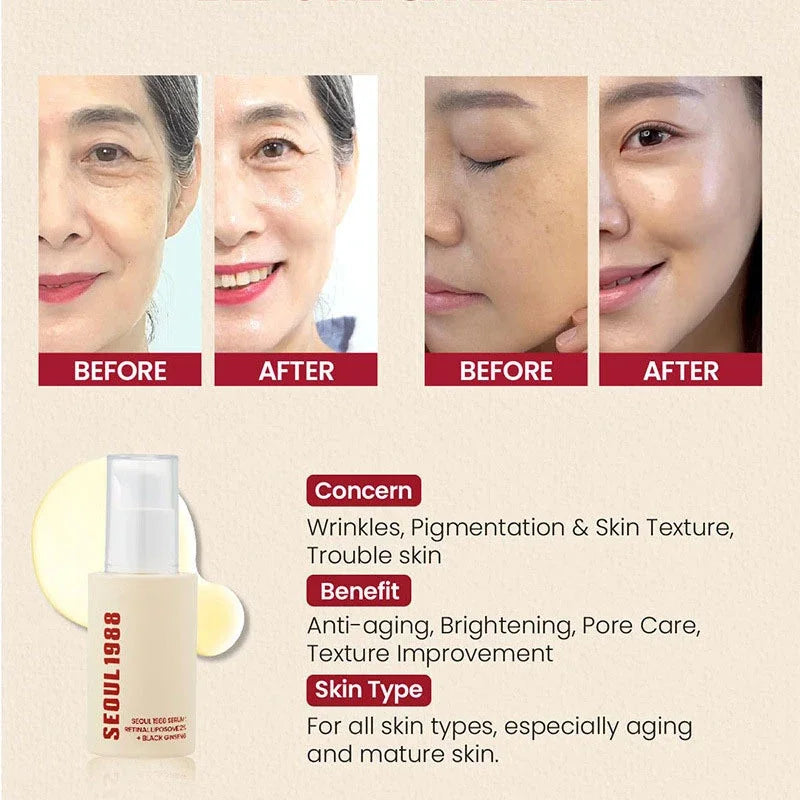 Sheromom's Korean Brand Skin Care Set Seoul 1988 Anti-aging Brightening Eye Cream Sunscreen Anti-wrinkle Essence Rice Cream Essence Water
