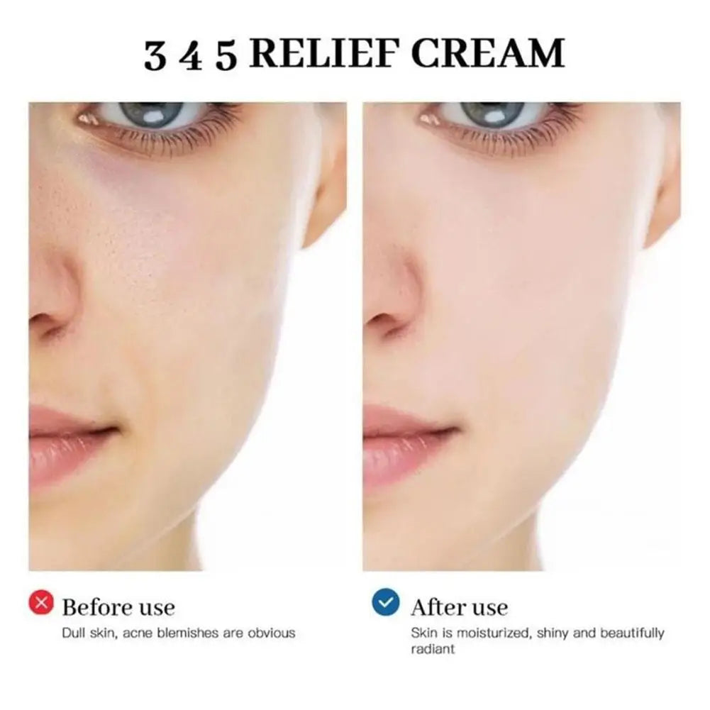 Sheromom's Korean 345 Antioxidant Cream 50ml - Moisturizing Intensive Barrier Repair Oil-control, Soothing for Acne Oily Sensitive Skin