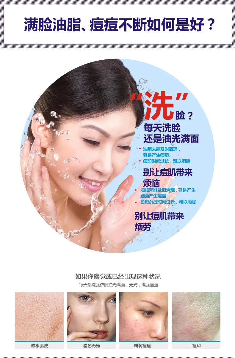 Sheromom's Treatment Cream Face Acne Remover Repair Gel Oil Control Serum Shrink Pores Whitening Facial mask Skin Care Korean Cosmetic