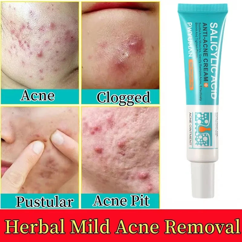 Sheromom's Salicylic Acid Acne Cream Shrink Pores Blackheads Scars Acne Marks Blemishes Oil Control Whitening Korean Skin Care Products