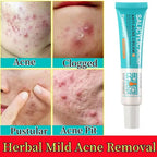 Sheromom's Salicylic Acid Acne Cream Shrink Pores Blackheads Scars Acne Marks Blemishes Oil Control Whitening Korean Skin Care Products