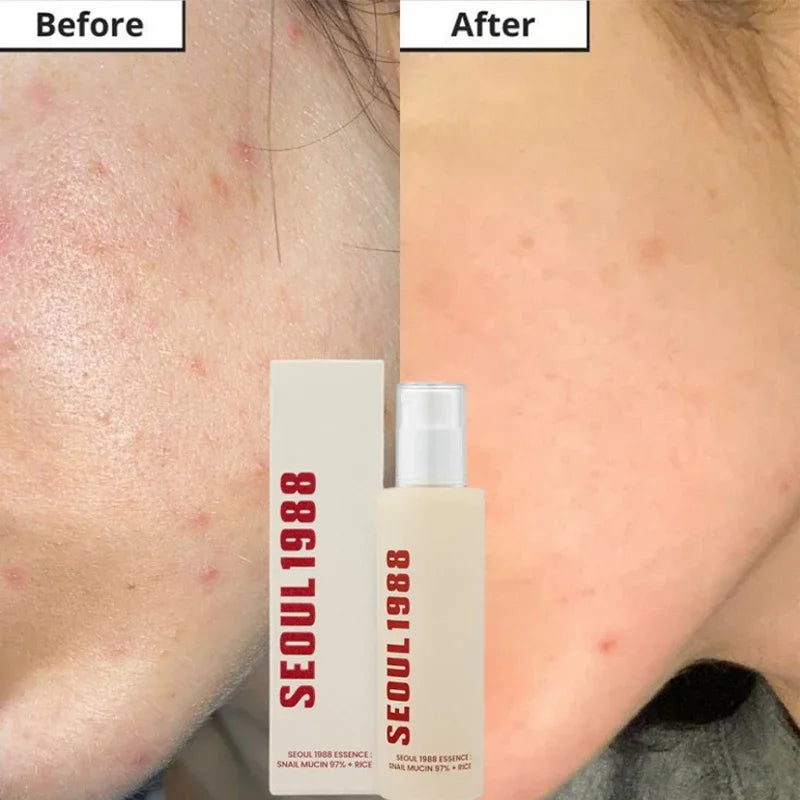 Sheromom's Korean Brand Skin Care Set Seoul 1988 Anti-aging Brightening Eye Cream Sunscreen Anti-wrinkle Essence Rice Cream Essence Water